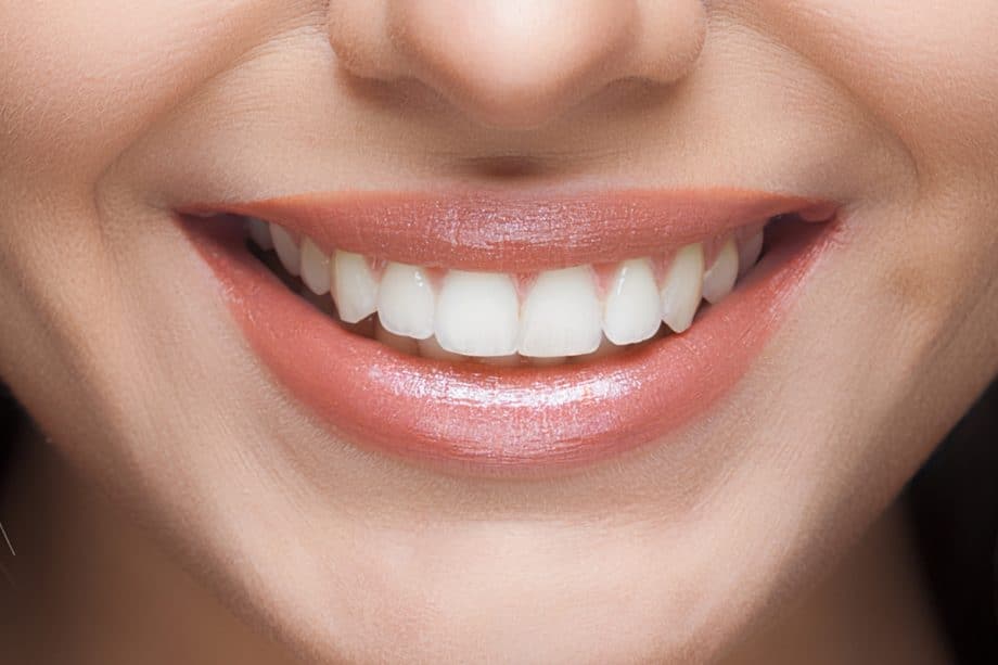 The Hidden Dangers of Tartar Buildup Reigate