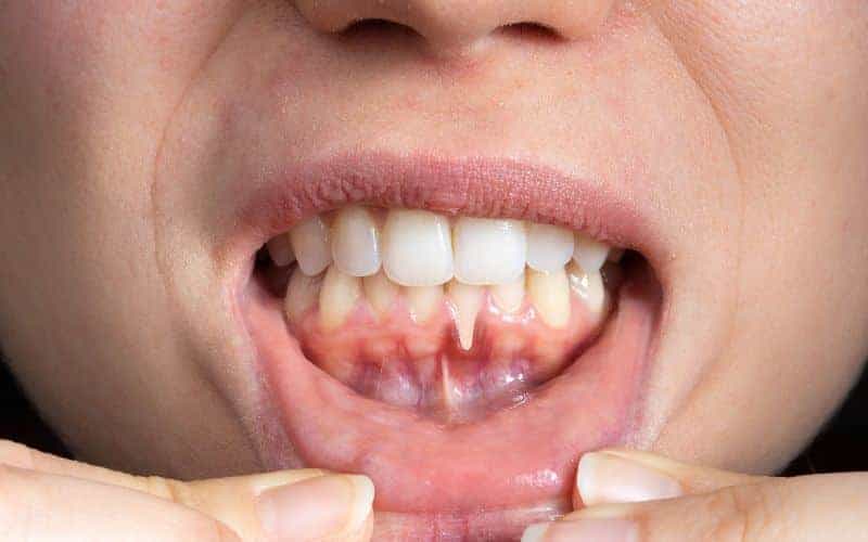 Final Thoughts: Building Lifelong Enamel Protection Habits Reigate
