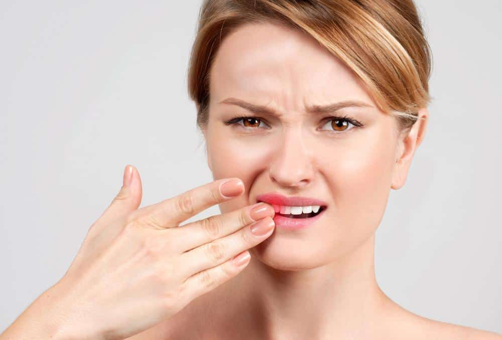 Does Laser Teeth Whitening Hurt or Cause Sensitivity Reigate?