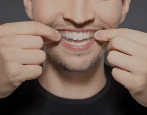 Overview of Home Teeth Whitening Kits Reigate
