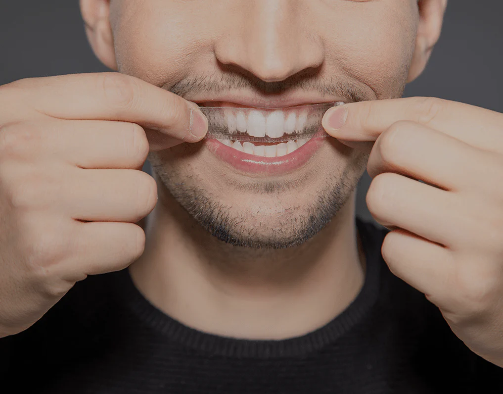 How Are Invisible Aligners Changing Orthodontic Treatments Reigate?