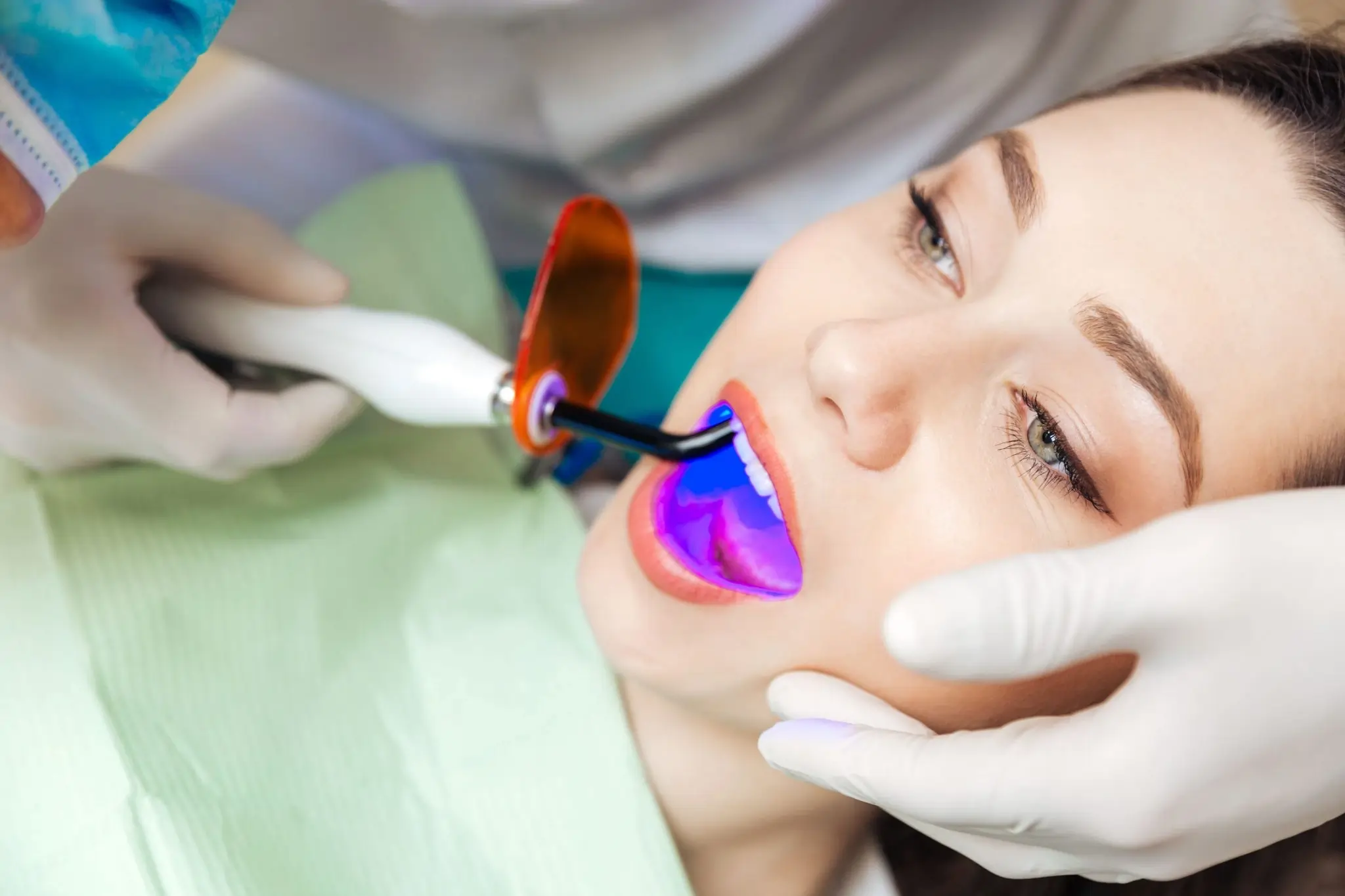 What Exactly Is Laser Teeth Whitening and How Does It Work Reigate?