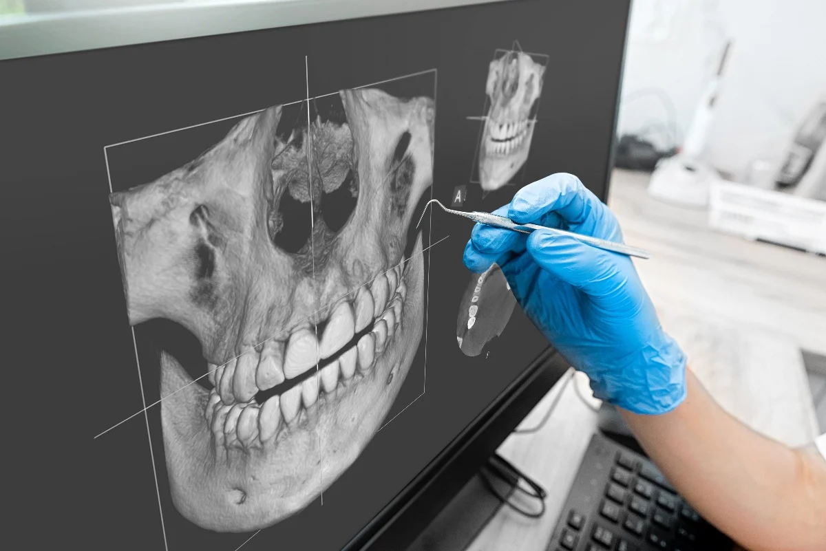 How Is AI Transforming Dental Treatment Planning Reigate?