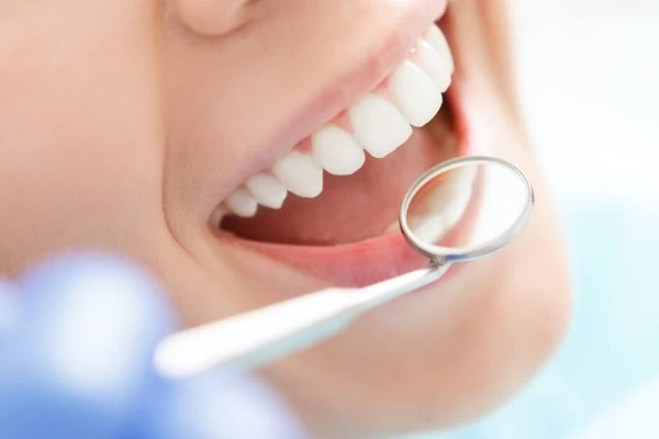 Preventing White Spots on Teeth Reigate
