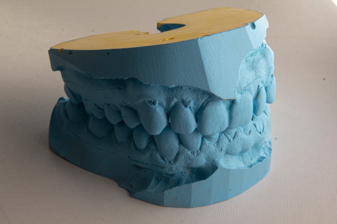 How Do Dental Implants Improve Jawbone Health and Oral Function Reigate?