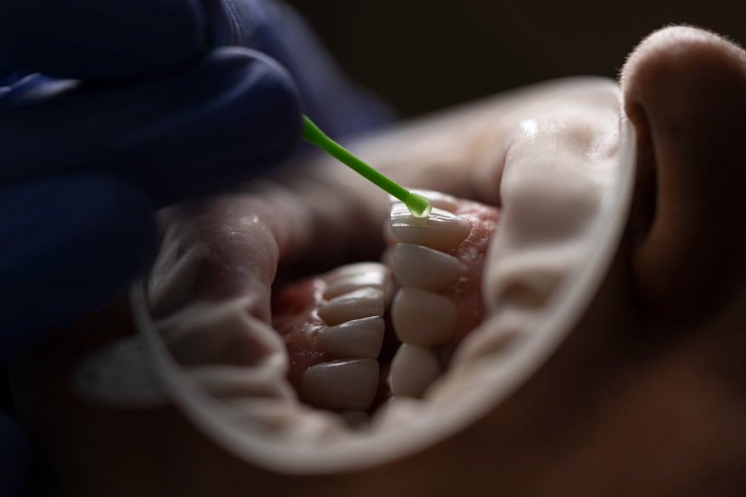 How Saliva Protects Your Teeth and Gums Reigate