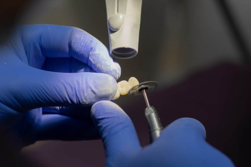 Customised Dental Solutions: Crowns, Aligners, and Implants Reigate