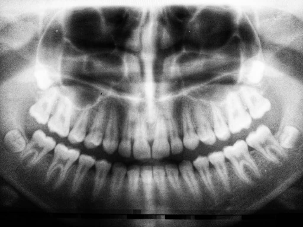 The Future of 3D Printing in Oral Healthcare Reigate